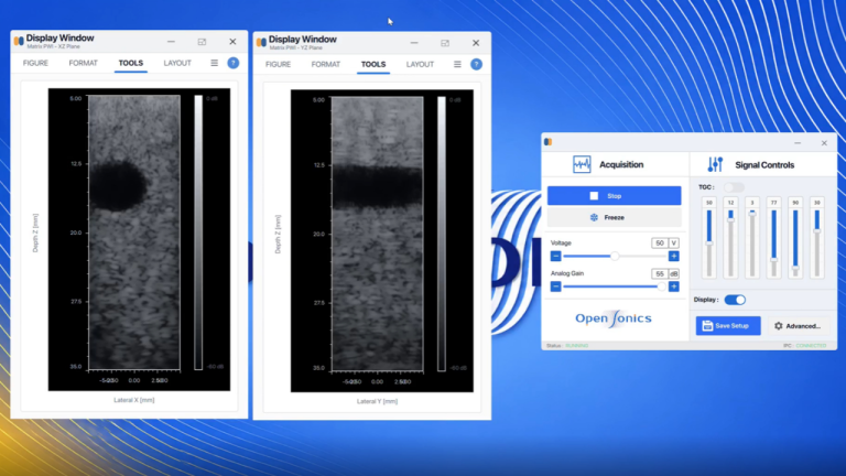 Live ultrasound imaging demonstration on the OpenSonics booth at IEEE IUS 2026